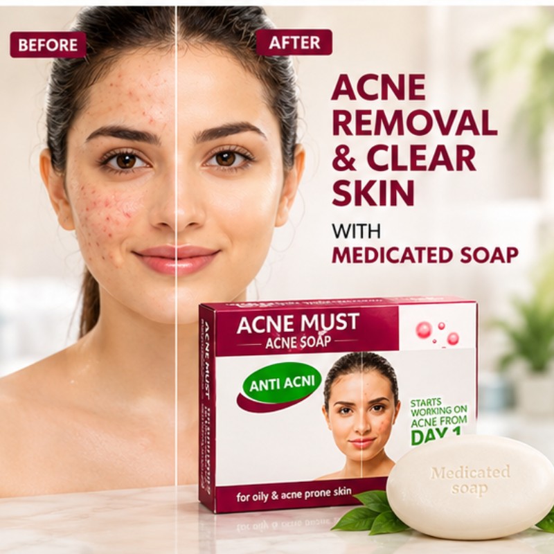 Acne Must – Anti-Acne Medicated Soap - Care & Glow